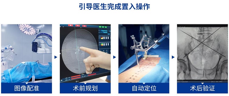 骨科手術(shù)機器人標(biāo)準(zhǔn)化流程